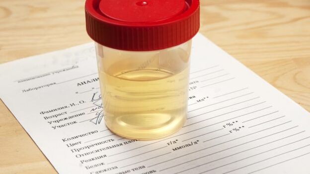 Urinanalyse für arterielle Hypertonie